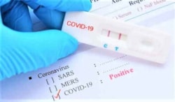List Of Covid-19 Testing In Vietnam | Location, Price, Tips (Update 2022)